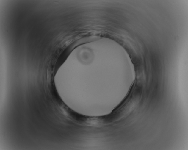X0000086940231200705141808