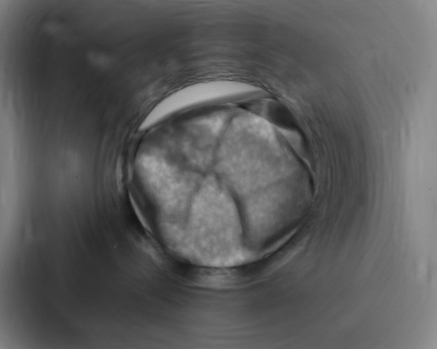X0000086940288200705141808