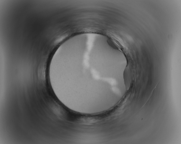 X0000086940299200705141807