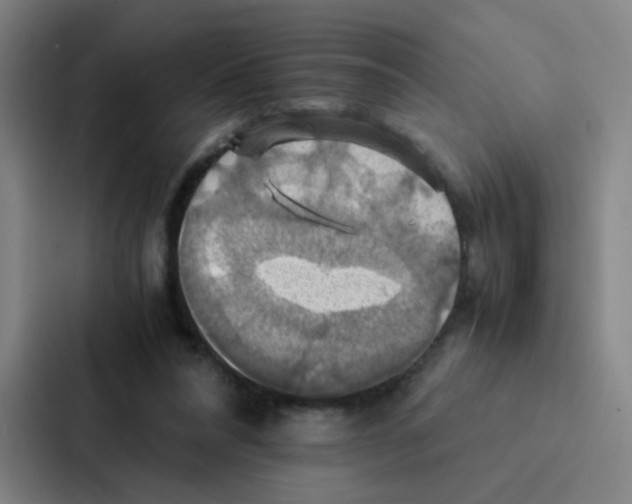 X0000086940304200705141807