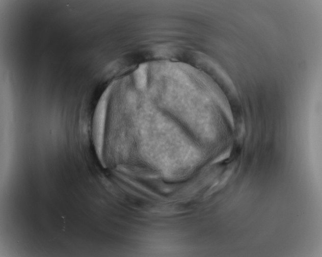 X0000086940329200705141807