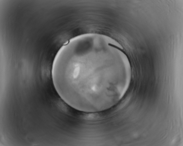 X0000086940382200705141807