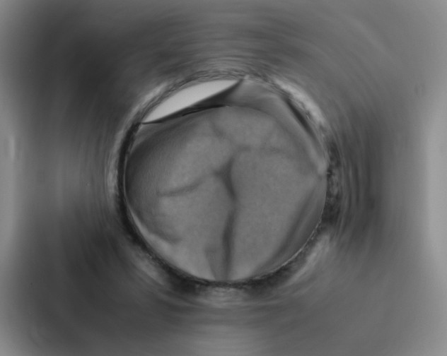 X0000086940399200705141806