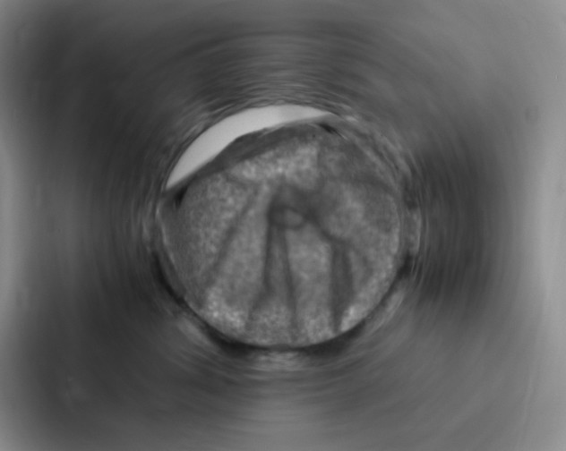 X0000086940428200705141806