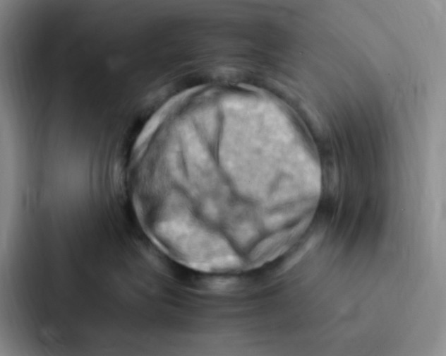 X0000086940575200705141804