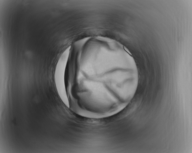 X0000086940624200705141803