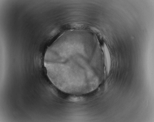 X0000086940712200705141802