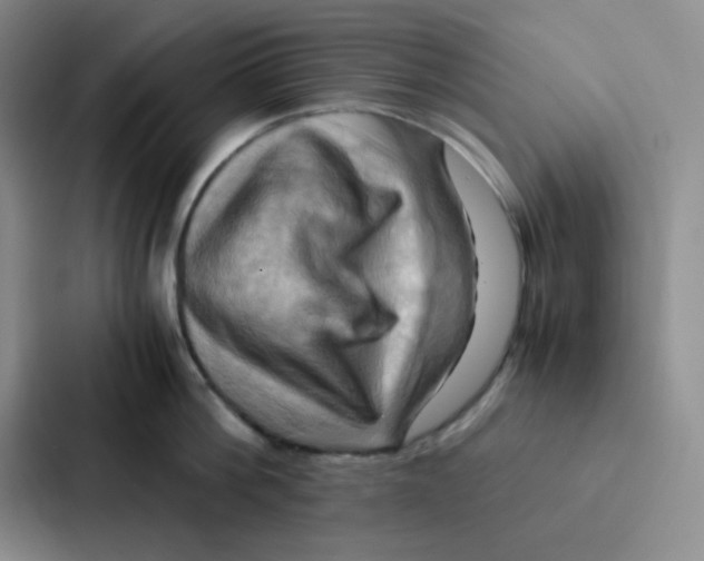 X0000086940812200705141801