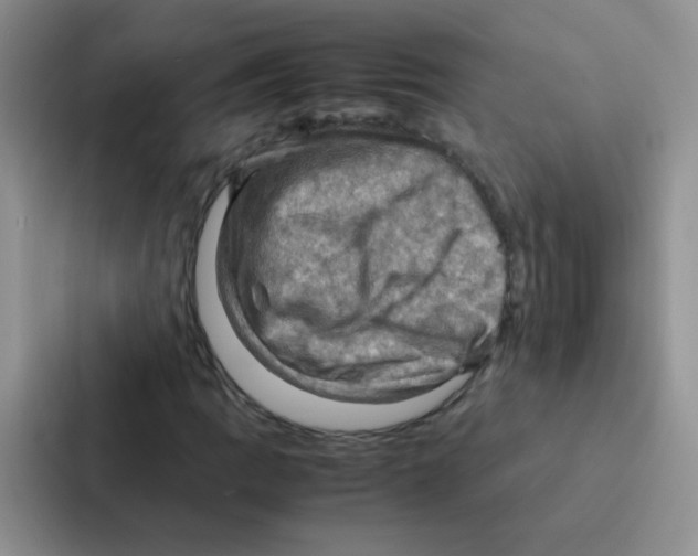 X0000086941109200705141756