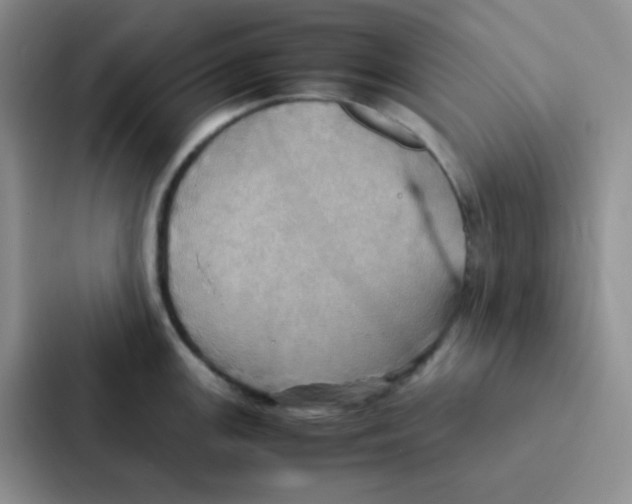 X0000086941147200705141757