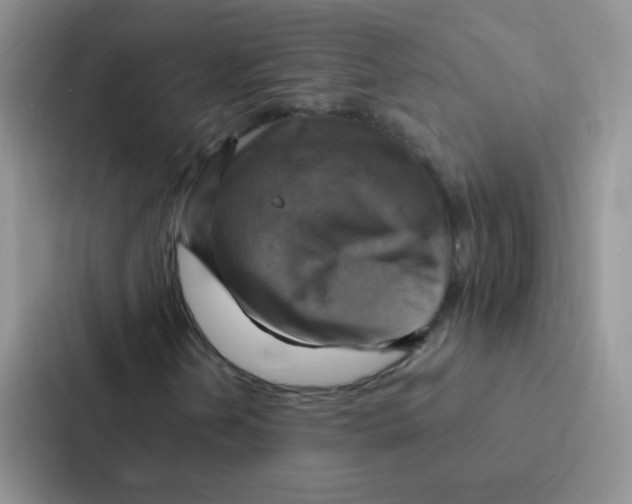 X0000086941202200705141755