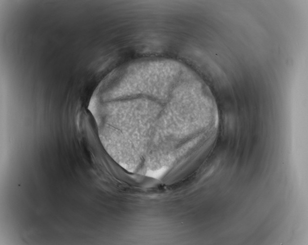 X0000086941250200705141755