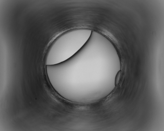 X0000086950155200704161105