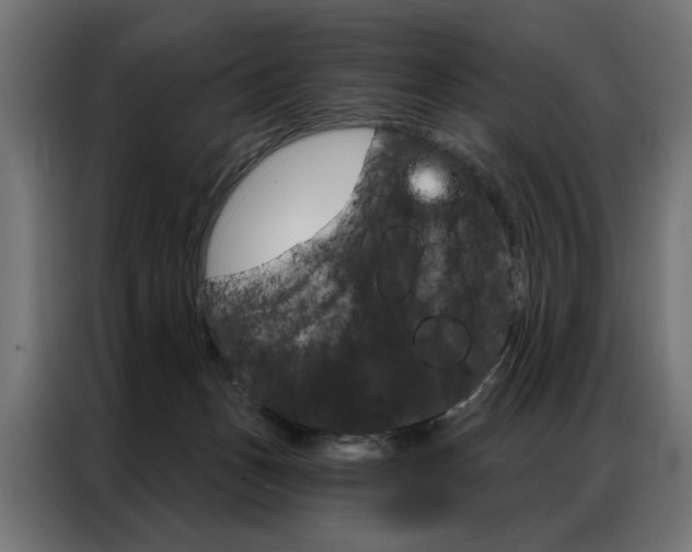 X0000086950175200704161105