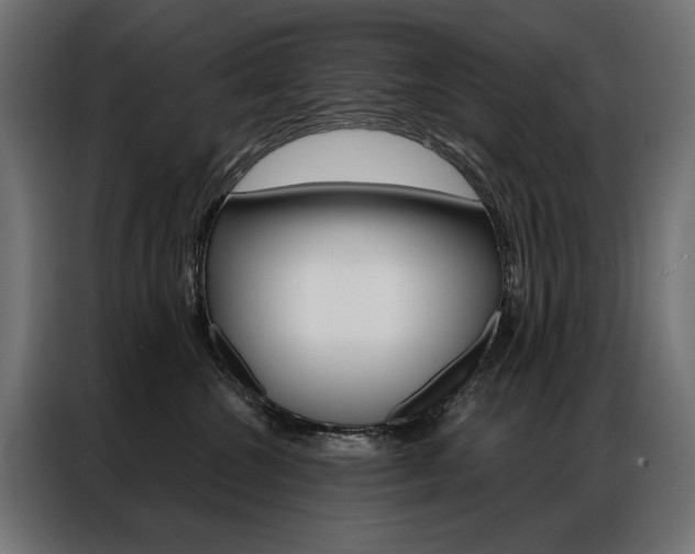 X0000086950572200704161100