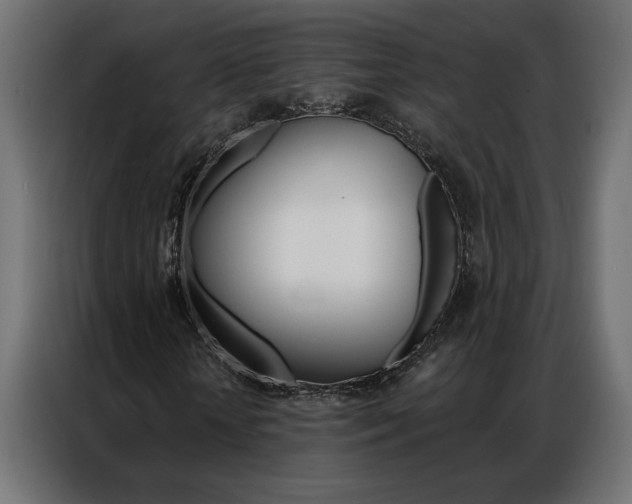 X0000086950818200704161055
