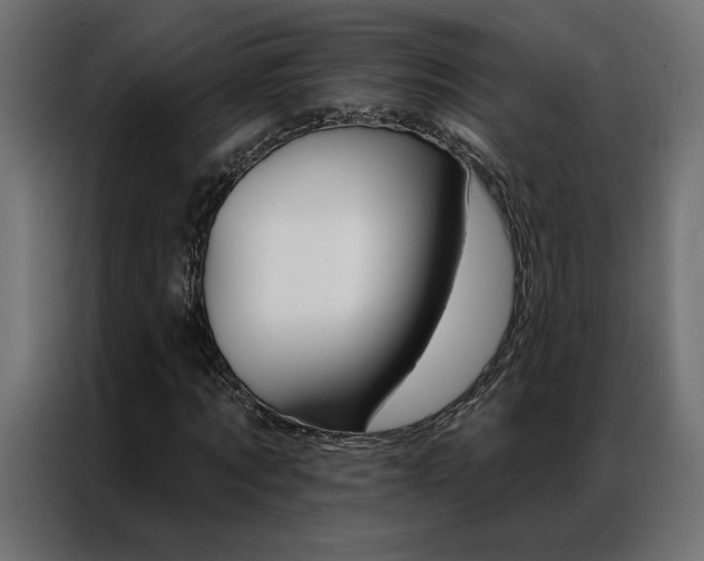 X0000086950869200704161055