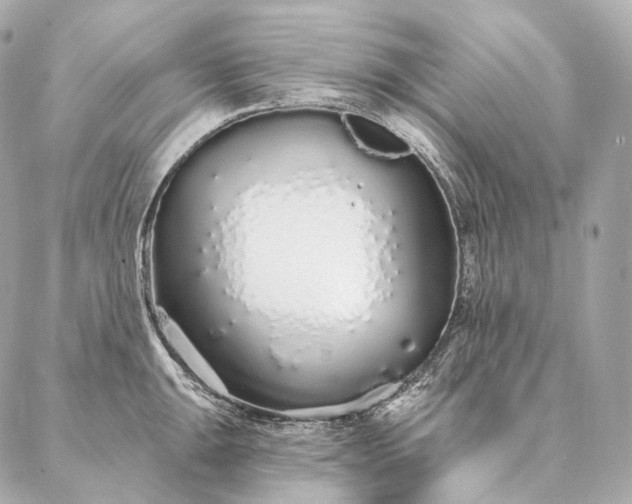 X0000086951047200704231420