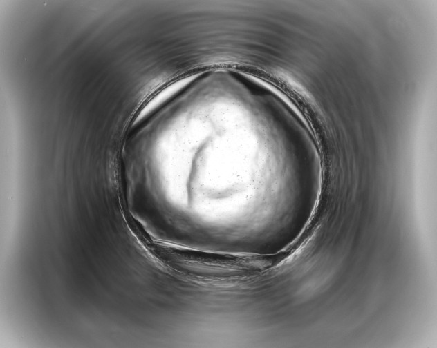 X0000086951329200704301210