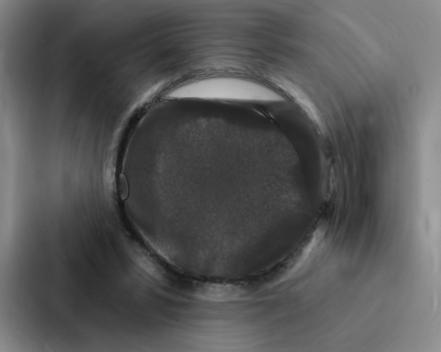 X0000086950399200705141826