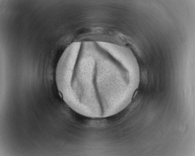 X0000086950571200705141824