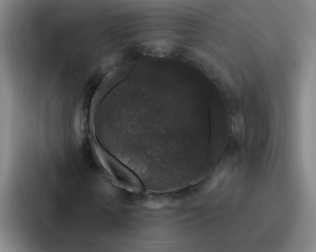 X0000086950818200705141820