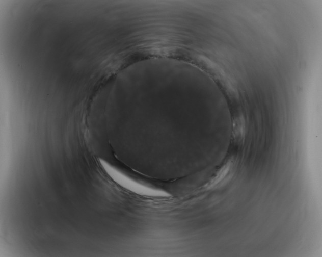 X0000086951202200705141815