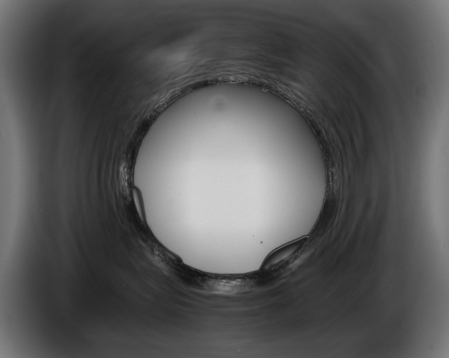 X0000086960575200704161127