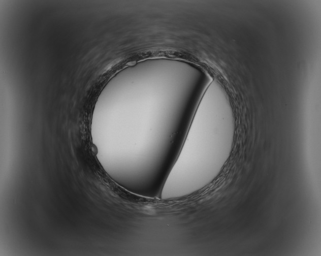 X0000086961159200704161117