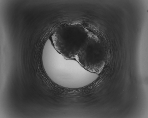 X0000086961393200704161113