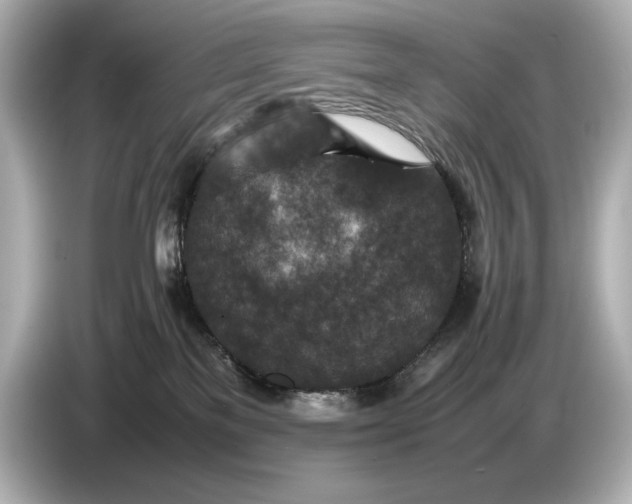 X0000086960137200704301245