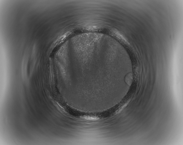 X0000086960644200704301238
