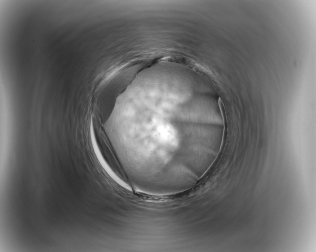 X0000086960720200704301237