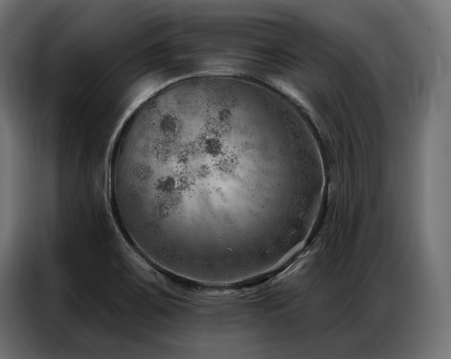 X0000086981467200704161439