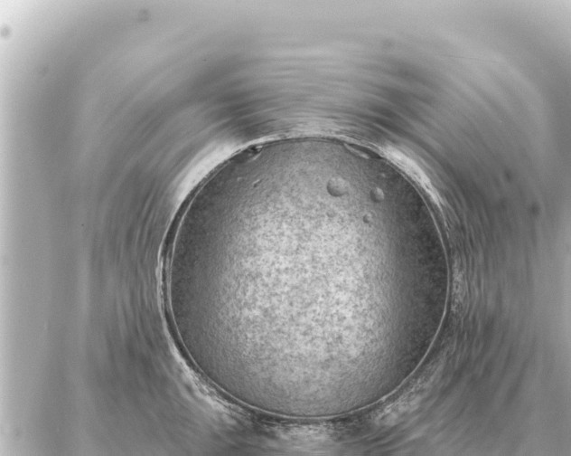 X0000086981047200704231814