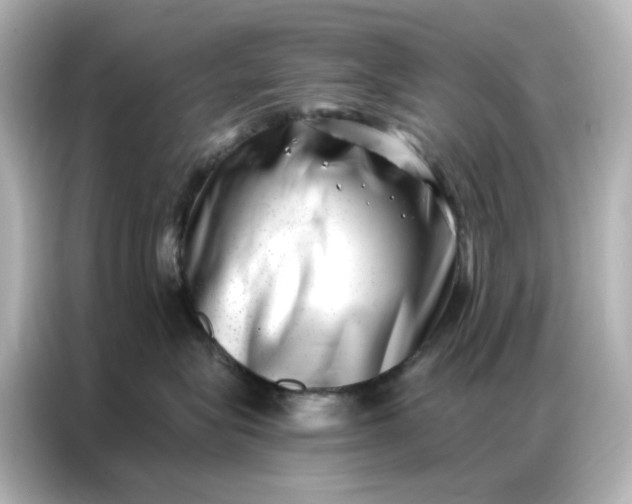 X0000086980575200704301320