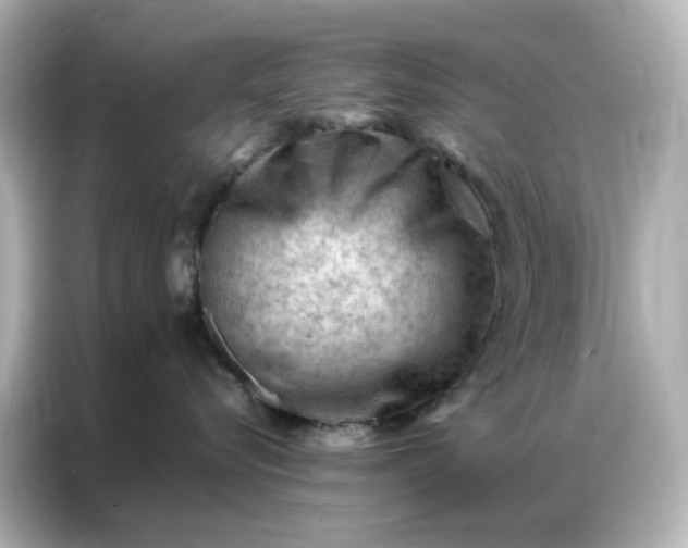 X0000086980576200704301320