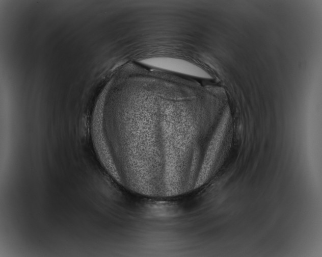 X0000086980467200705071420