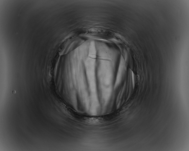 X0000086980566200705071419