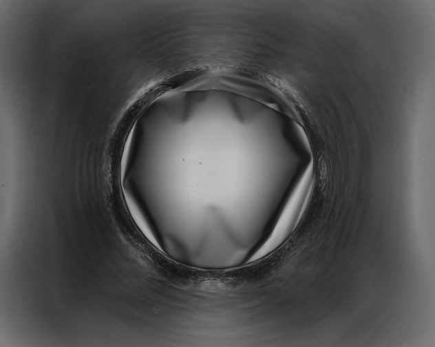 X0000086980684200705071417