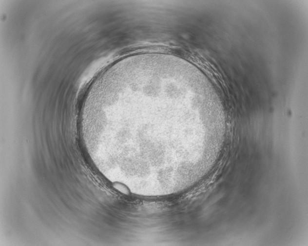 X0000086980149200705141724