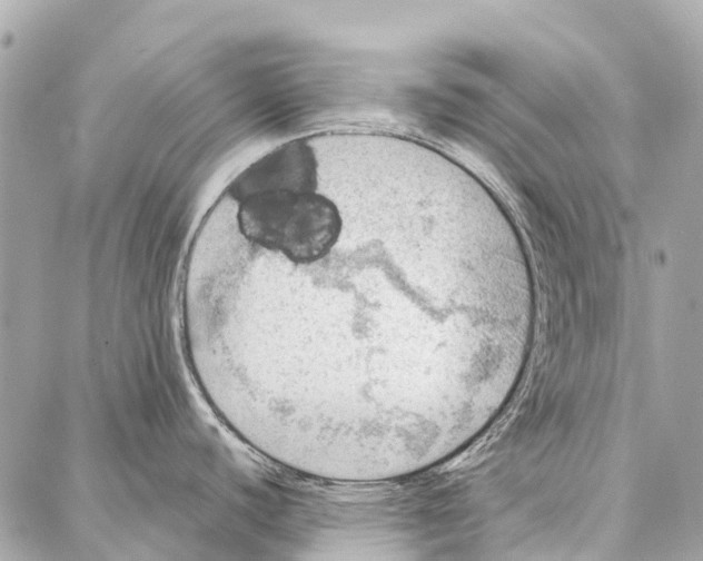 X0000086981440200705141705