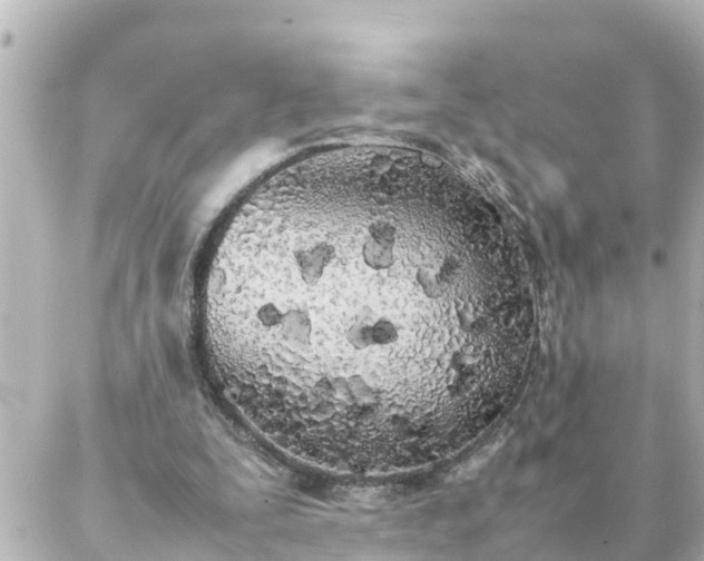 X0000086990295200704231852