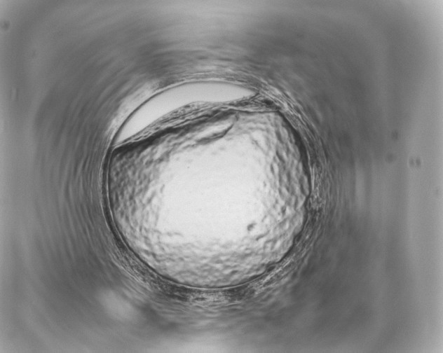 X0000086990099200705141751