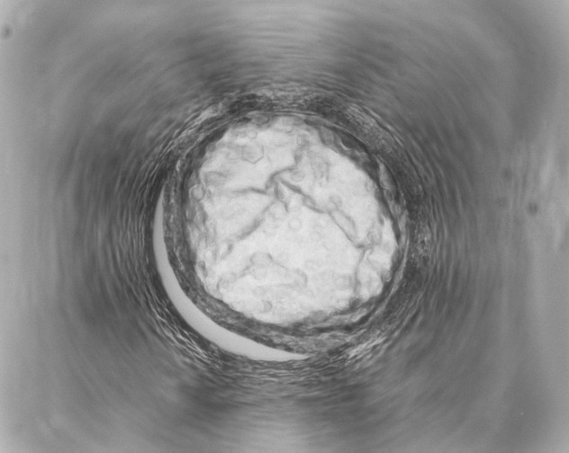 X0000086991010200705141735