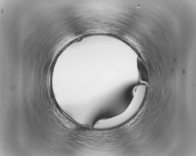 X0000086991179200705141733