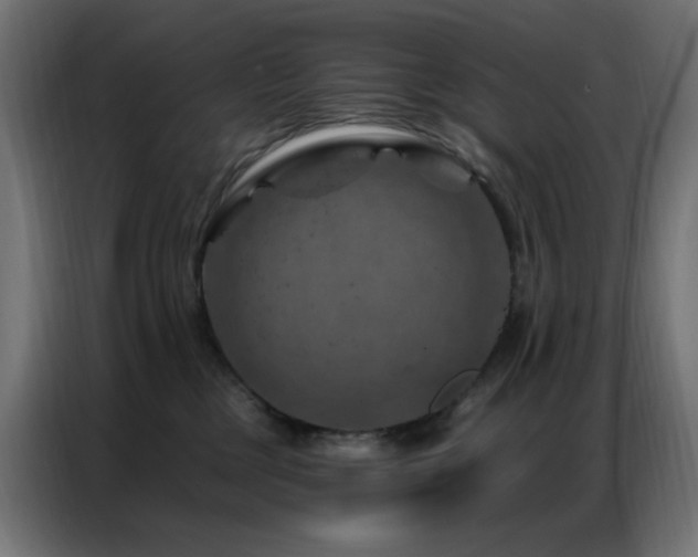 X0000087000377200704161528