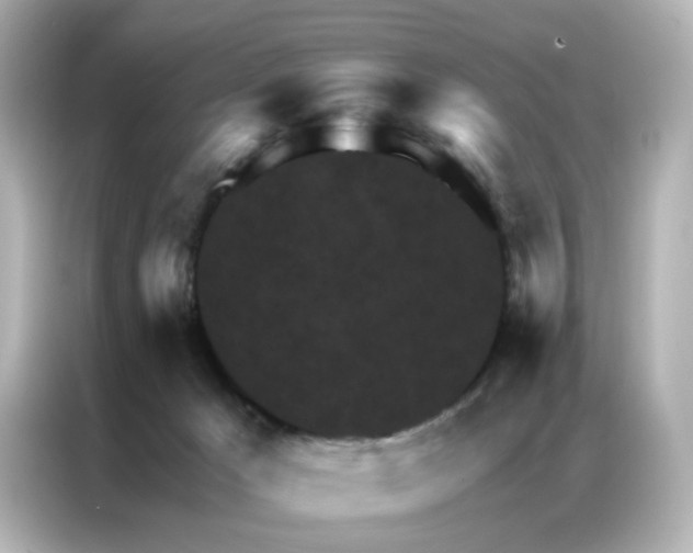 X0000087000029200704301406