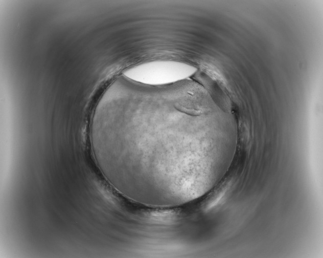 X0000087000357200704301402
