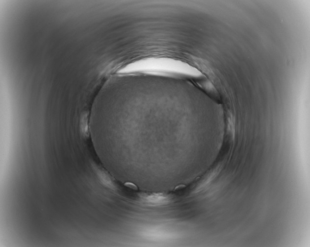 X0000087000383200704301402